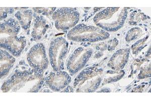 ABIN6269323 at 1/100 staining Human prostate tissue by IHC-P. (LIPE Antikörper  (Internal Region))
