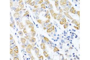 Immunohistochemistry of paraffin-embedded Human stomach using CDKN2C Polyclonal Antibody at dilution of 1:100 (40x lens). (CDKN2C Antikörper)