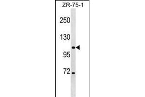 CLCN3 Antibody (Center) (ABIN1538244 and ABIN2848797) western blot analysis in ZR-75-1 cell line lysates (35 μg/lane). (CLCN3 Antikörper  (AA 285-313))