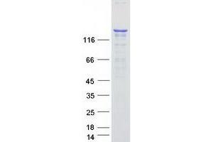 Western Blotting (WB) image for Nitric Oxide Synthase 1, Neuronal (NOS1) protein (Myc-DYKDDDDK Tag) (ABIN2727468)