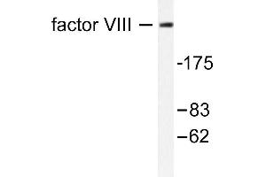Image no. 1 for anti-Coagulation Factor VIII (F8) antibody (ABIN265412) (Factor VIII Antikörper)