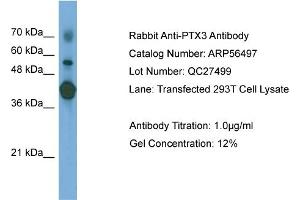 WB Suggested Anti-PTX3  Antibody Titration: 0. (PTX3 Antikörper  (N-Term))