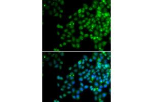 Immunofluorescence analysis of HeLa cells using EPC1 antibody. (EPC1 Antikörper)