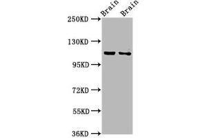 Western Blot Positive WB detected in: Rat brain tissue, Mouse brain tissue All lanes: CLIP2 antibody at 3. (CLIP2 Antikörper  (AA 101-217))