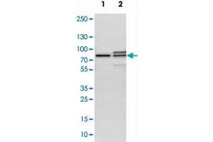 Western blot analysis of cell lysates with MTA2 polyclonal antibody  at 1:250-1:500 dilution.
