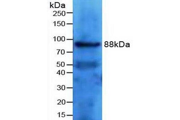 Transferrin Receptor 2 Antikörper  (AA 86-259)