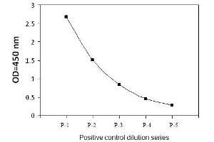 HeLa cells were treated with Calyculin A. (TBK1 ELISA Kit)