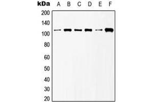 Western blot analysis of mGLUR6 expression in HeLa (A), NIH3T3 (B), Raw264. (Metabotropic Glutamate Receptor 6 Antikörper  (C-Term))