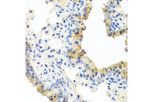 Immunohistochemistry of paraffin-embedded mouse lung using FECH antibody at dilution of 1:100 (x40 lens). (FECH Antikörper)