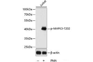Western blot analysis of extracts of Jurkat cells using Phospho-MAPK3(T202) Polyclonal Antibody at dilution of 1:2000. (ERK1 Antikörper  (pThr202))