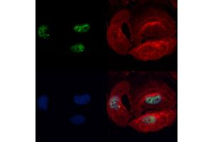 ABIN7093833 and ABIN7097876 staining Hela cells by IF/ICC. (BBX Antikörper  (N-Term))