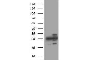 Image no. 1 for anti-Proteasome Subunit alpha 2 (PSMA2) (AA 50-234) antibody (ABIN1491571) (PSMA2 Antikörper  (AA 50-234))