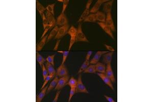 Immunofluorescence analysis of NIH-3T3 cells using ST Rabbit mAb (ABIN1681118, ABIN7101700, ABIN7101701 and ABIN7101702) at dilution of 1:100 (40x lens). (STAT4 Antikörper)