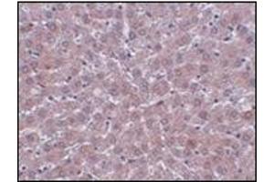 Immunohistochemistry of JMJD1B in rat liver tissue with this product at 2.