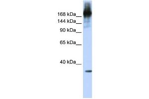 WB Suggested Anti-PRPF8 Antibody Titration:  0. (PRPF8 Antikörper  (N-Term))