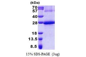 SDS-PAGE (SDS) image for NADH Dehydrogenase (Ubiquinone) 1 beta Subcomplex, 9, 22kDa (NDUFB9) (AA 1-179) protein (His tag) (ABIN5853175)