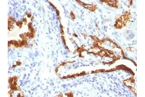 Image no. 3 for anti-Keratin 18 (KRT18) antibody (ABIN6179389) (Cytokeratin 18 Antikörper)