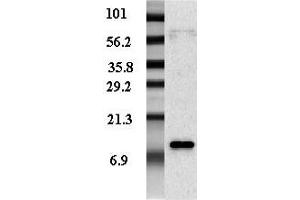 Western blot analysis of adipocyte-conditioned medium from human male and female with different expression levels using anti-Resistin (human), pAb (Biotin) .