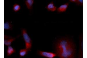 Immunofluorescence (IF) image for anti-Eukaryotic Translation Initiation Factor 1B (EIF1B) (AA 1-113) antibody (PE) (ABIN5567955) (EIF1B Antikörper  (AA 1-113) (PE))