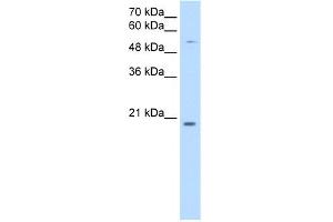 WB Suggested Anti-CHIC2 Antibody Titration:  0.