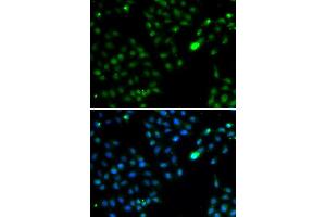 Immunofluorescence analysis of HeLa cells using FKBP3 antibody (ABIN5974155). (FKBP3 Antikörper)