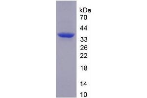 SDS-PAGE analysis of recombinant Human TNIP2 Protein. (TNIP2 Protein)