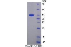 Image no. 1 for Protocadherin 1 (PCDH1) (AA 246-517) protein (His tag) (ABIN4988683)