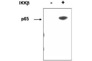 Western blot using  affinity purified anti-p65 (RelA) pS536 antibody shows detection of p65 phosphorylated at S536. (NF-kB p65 Antikörper  (pSer276))