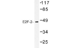 Image no. 1 for anti-E2F Transcription Factor 2 (E2F2) antibody (ABIN272230) (E2F2 Antikörper)