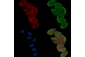 ABIN6262048 and ABIN6268844 staining Hela cells(30 min of UV treatment) by IF/ICC. (QRFPR Antikörper  (Internal Region))