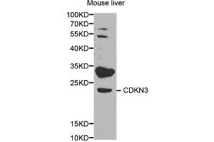 Western blot analysis of extracts of mouse liver, using CDKN3 antibody (ABIN5971092) at 1/1000 dilution. (CDKN3 Antikörper)