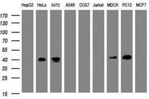 Image no. 1 for anti-NudE Nuclear Distribution E Homolog (A. Nidulans)-Like 1 (NDEL1) antibody (ABIN1499857) (NDEL1 Antikörper)