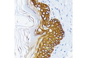 Immunohistochemistry of paraffin-embedded rat skin using Cytokeratin 14 (KRT14) (KRT14) Rabbit mAb (ABIN7268091) at dilution of 1:100 (40x lens). (KRT14 Antikörper)