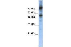 WB Suggested Anti-FOXM1 Antibody Titration:  0. (FOXM1 Antikörper  (Middle Region))