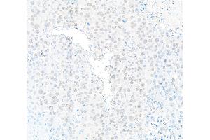 Immunohistochemistry (IHC) image for anti-Protein Phosphatase 4, Catalytic Subunit (PPP4C) (AA 1-50) antibody (ABIN7454679) (PPP4C Antikörper  (AA 1-50))