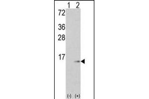 Western blot analysis of S100A6 (arrow) using rabbit polyclonal S100A6 Antibody (C-term) (ABIN391522 and ABIN2841482). (S100A6 Antikörper  (C-Term))