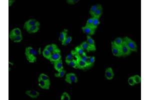 Immunofluorescence staining of HepG2 cells with ABIN7142134 at 1:100, counter-stained with DAPI. (MOGAT1 Antikörper  (AA 163-246))