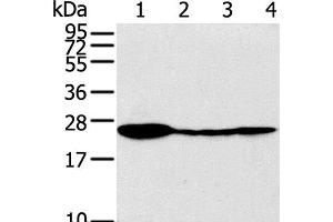 Western Blot analysis of Raji, 231, 293T and A549 cell using TPD52 Polyclonal Antibody at dilution of 1:320 (TPD52 Antikörper)