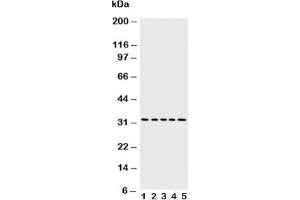 Western blot testing of Caspase-6 antibody and Lane 1:  MCF-7;  2: HeLa;  3: Jurkat;  4: CEM;  5: SW620 cell lysate (Caspase 6 Antikörper  (AA 24-44))