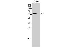 Western Blotting (WB) image for anti-Deoxynucleotidyltransferase, terminal (DNTT) (Internal Region) antibody (ABIN3187218)
