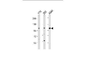 All lanes : Anti-hNEK4- at 1:2000 dilution Lane 1: Y79 whole cell lysate Lane 2: 293 whole cell lysate Lane 3: A549 whole cell lysate Lysates/proteins at 20 μg per lane.
