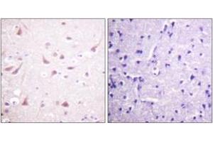 Immunohistochemistry analysis of paraffin-embedded human brain tissue, using DRP-2 (Ab-514) Antibody. (DRP2 Antikörper  (AA 480-529))