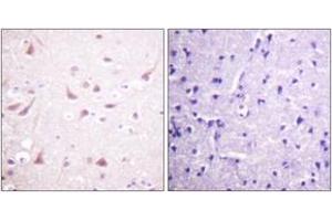 Immunohistochemistry analysis of paraffin-embedded human brain tissue, using DRP-2 (Ab-514) Antibody.