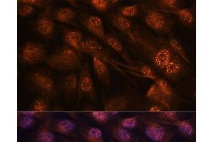 Immunofluorescence analysis of C6 cells using MAP2K7 Polyclonal Antibody at dilution of 1:100. (MAP2K7 Antikörper)