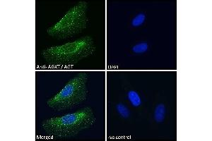 ABIN570702 Immunofluorescence analysis of paraformaldehyde fixed HeLa cells, permeabilized with 0. (AGXT Antikörper  (Internal Region))