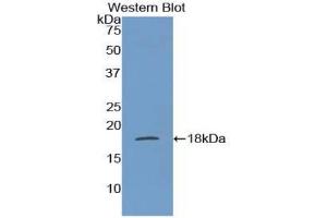 Detection of Recombinant FABP1, Mouse using Polyclonal Antibody to Fatty Acid Binding Protein 1 (FABP1) (FABP1 Antikörper  (AA 1-127))