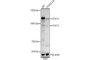 Western blot analysis of extracts from wild type(WT) and ST knockdown (KD) 293T cells, using ST antibody (ABIN1678782, ABIN3017845, ABIN3017846 and ABIN7101526) at 1:1000 dilution. (STAT2 Antikörper)