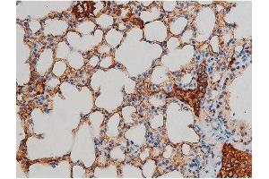 ABIN6267395 at 1/200 staining Mouse lung tissue sections by IHC-P. (GATA1 Antikörper  (pSer142))