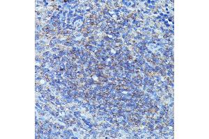 Immunohistochemistry of paraffin-embedded mouse spleen using CSF3 antibody (ABIN6127710, ABIN6139100, ABIN6139101 and ABIN6221772) at dilution of 1:100 (40x lens). (G-CSF Antikörper  (AA 30-207))