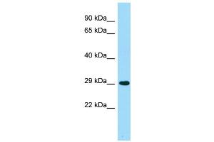 WB Suggested Anti-ACER2 Antibody Titration: 1.